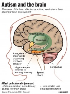 brain in autism